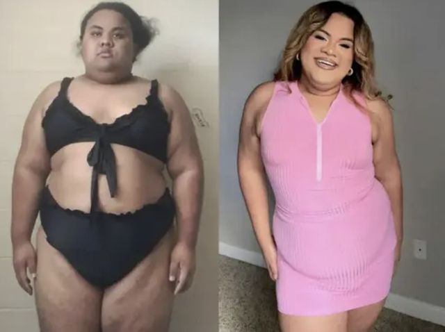 몸무게가 190㎏에 육박했던 20대 여성이 '체중 감량 수술'을 받고 약 70㎏를 뺐다는 사연이 알려졌다. /사진=사우스 차이나 모닝 포스트