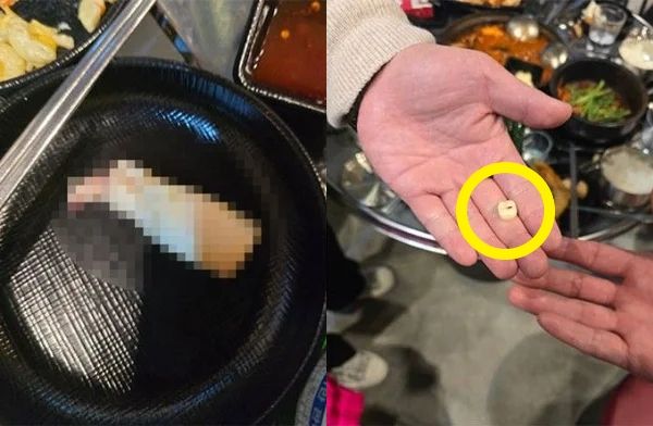 인천의 한 찌갯집 사장이 음식을 먹다 시술한 래미네이트가 빠진 손님으로부터 협박을 당했다고 토로했다. 사진은 사장이 공유한 손님의 래미네이트 모습. /사진='아프니까 사장이다' 캡처