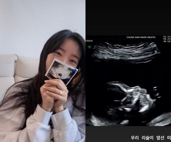 배우 배슬기의 근황이 공개됐다. /사진=배슬기 인스타그램