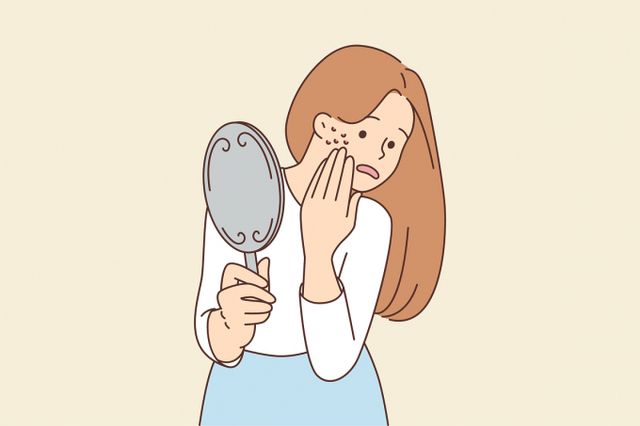여드름은 의사에게 전문적인 치료를 받는 게 효과적이다. 여드름 예방에 집중하는 것도 필요하다. 이미지는 기사 내용과 직접적인 관련이 없음. /사진=이미지투데이