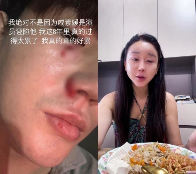 함소원의 남편 진화가 폭행 피해를 폭로했다. /사진=진화 인스타그램