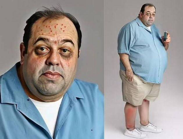 초가공 식품을 즐겨 먹은 남성의 30년 후 모습을 예측한 충격적인 모습을 공개했다. /사진=데일리메일 캡처