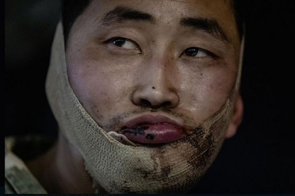 우크라이나 군에 생포된 러시아 파병 북한군이 한국으로 귀순 의사를 밝혔다. 사진은 우크라이나 군에 생포된 북한군 포로. /사진=젤렌스키 우크라이나 대통령 엑스 캡처