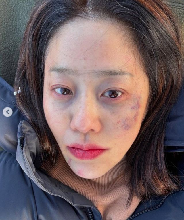 고현정이 멍투성이로 분장한 얼굴을 공개했다. /사진=고현정 인스타그램