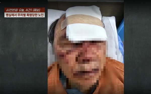 정신병원에 입원 중인 80대 노인이 같은 병실 30대 청년에게 무자비한 폭행을 당하는 사건이 발생했다. 사진은 청년에게 폭행당한 80대 노인이 피투성이가 된 모습. /사진=JTBC '사건반장' 캡처