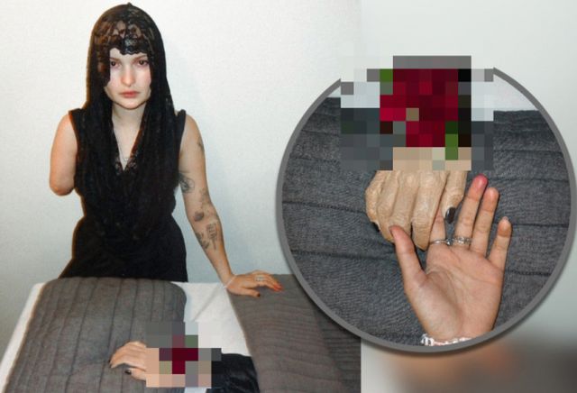 한 여성이 암으로 절단한 오른팔을 위한 장례식을 치러 화제다. /사진=SCMP 캡처