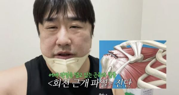 강재준이 육아로 인해 회전근개 파열 진단을 받았다. 사진은 강재준이 회전근개 파열 통증을 호소하고 있는 모습. /사진=강재준 유튜브 채널 캡처