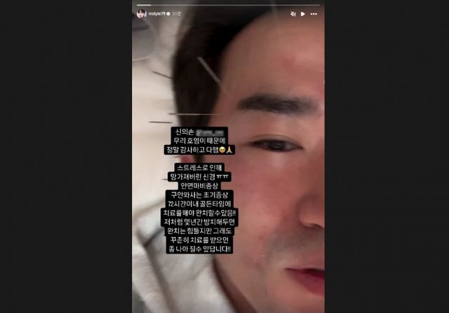 그룹 신화 이민우가 안면신경마비(구안와사) 증세를 겪고 있다고 털어놨다./사진=이민우 인스타그램