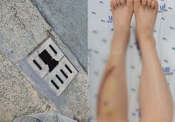 아기를 안고 걷던 여성이 깨진 하수구를 밟고 넘어지는 아찔한 사고를 당했다. 사진은 깨진 하수구와(왼쪽) 24바늘 꿰맨 A씨 부상 모습. /사진=A씨 인스타그랩 캡처