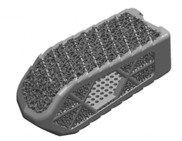 시지메드텍의 환자 맞춤형 척추 케이지가 제조품목 허가를 획득했다. /사진=시지메드텍