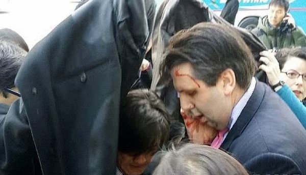 마크 리퍼트 주한미국대사가 괴한 공격으로 부상을 입었다. 사진은 흉기 피습을 당한 마크 리퍼트 주한미국대사. /사진=뉴스1