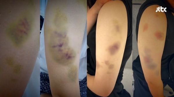 사진은 코치에게 폭행당한 여고생 선수들의 모습. /사진=JTBC '사건반장' 캡처