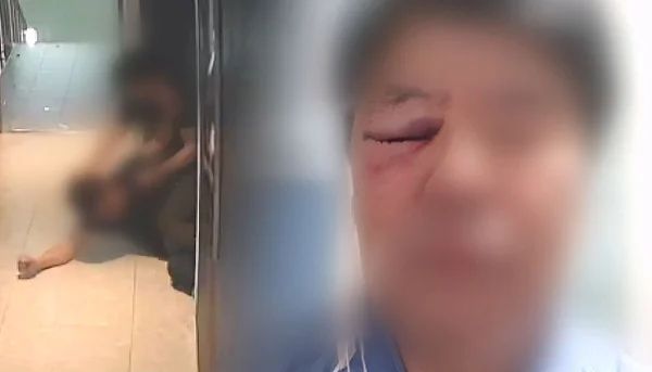 60대 무인모텔 사장이 20대 남성에게 별다른 이유 없이 폭행당했다. 사진은 60대 무인모텔 사장이 20대 남성에게 폭행당하는 모습(왼쪽)과 폭행당한 사장의 모습(오른쪽). /사진=JTBC '사건반장' 캡처