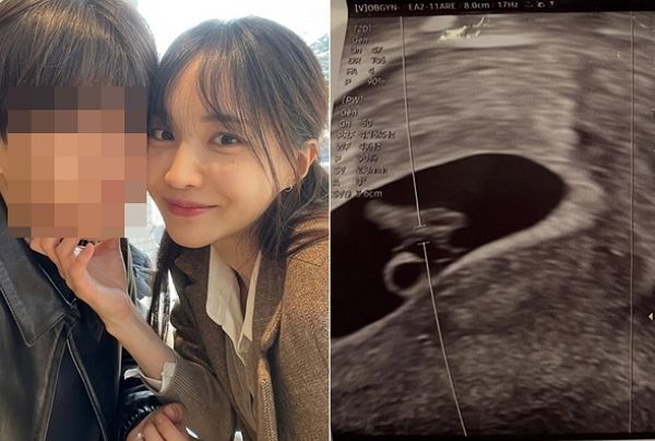 서은우가 임신 폭로, 스토킹 고소 이후 심경을 직접 밝혔다. 사진은 서은우와 서은우가 아이 아빠라고 주장한 남자친구의 모습(왼쪽)과 서은우가 공개한 초음파 사진(오른쪽). /사진=서은우 인스타그램 캡처