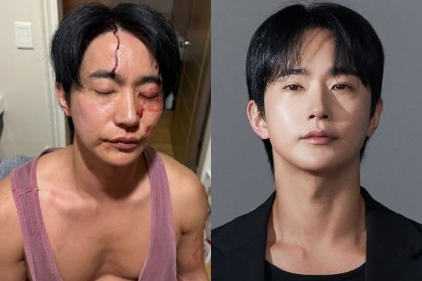 뮤지컬 배우 전호준이 전 연인을 폭행했다는 의혹이 제기되면서 그의 연극 '더 투나잇 쇼' 출연이 불발됐다. 사진은 자신의 폭행 피해를 주장한 전호준의 모습과 배우 전호준. /사진=전호준 인스타그램 캡처