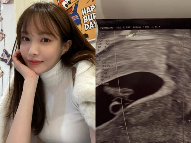 채널A '하트시그널3'에 출연했던 서은우가 임신 소식과 함께 남자친구에게 스토킹으로 고소 당했다고 밝혔다. 서은우와 그의 인스타그램에 올라온 초음파 사진. /사진=서은우 인스타그램 캡처