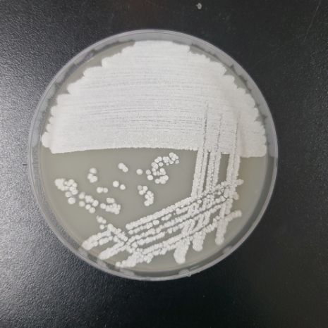 방선균 스트렙토마이세스 카나마이세티쿠스의 고체배지 배양 사진