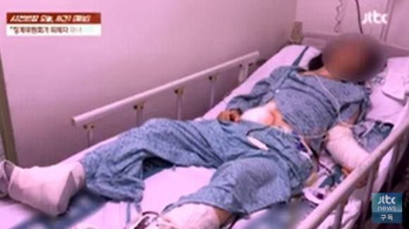 A씨가 투신 후 병원에 입원한 모습 사진JTBC
