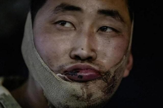 볼로디미르 젤렌스키 우크라이나 대통령이 지난달 11일 자신의 엑스X에 공개한 북한군 포로 리씨의 모습 사진연합뉴스 