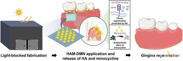 본 논문에서는 광 차단 제조공정을 적용하여 약물의 안정성이 유지된 치주염 패치를 제작했음. 제작된 패치는 간편한 적용 방식으로 구강 점막에 적용 가능하며 높은 약물전달 효율에 의해 빠르고 효과적인 치주염 치료를 가능하게 함.