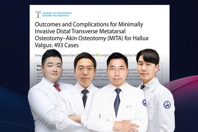 SNU서울병원 족부전담팀(서상교 대표원장, 이동오 원장, 강태병 원장, 이정환 원장)이 SCI급 국제학술지에 최소침습 무지외반증 수술(MITA) 논문을 발표했다(사진=SNU서울병원)