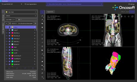 온코소프트의 AI 기반 자동 컨투어링 소프트웨어 ‘OncoStudio 2.0’(제공=온코소프트)