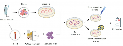 환자 유래 면역세포-오가노이드 공배양 기반 면역항암제 및 방사선 감수성 예측 과정