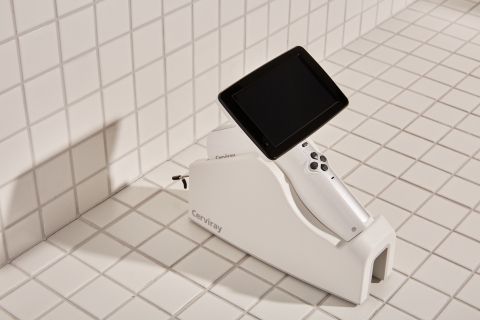 Cerviray A.I. 시스템