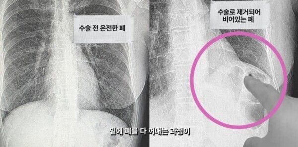 유튜브 채널 '혜영이는 못말려'