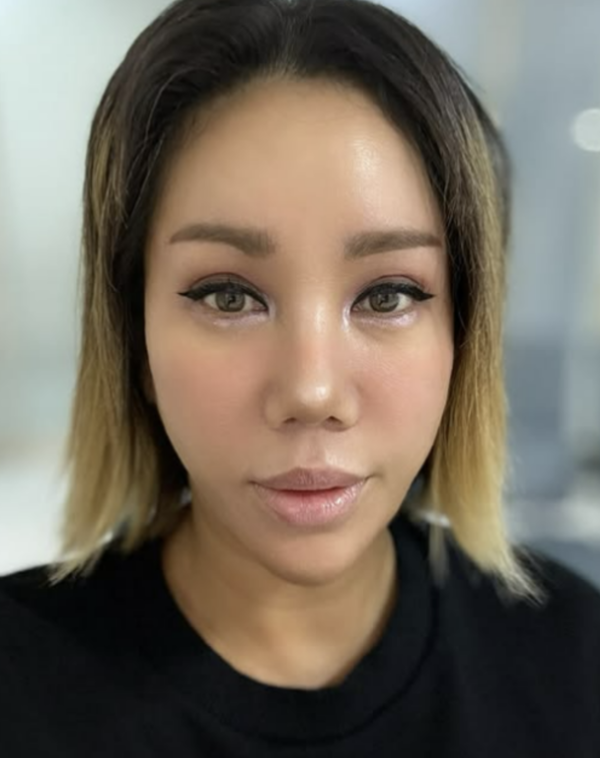 김송