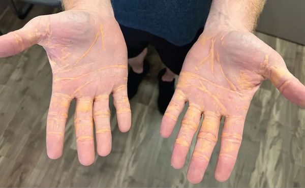 사진: JAMA Cardiology