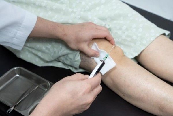사진설명=중기 무릎 관절염 환자에게&nbsp;PRP&nbsp;치료를 시행하고 있는 모습. (연세사랑병원 제공)