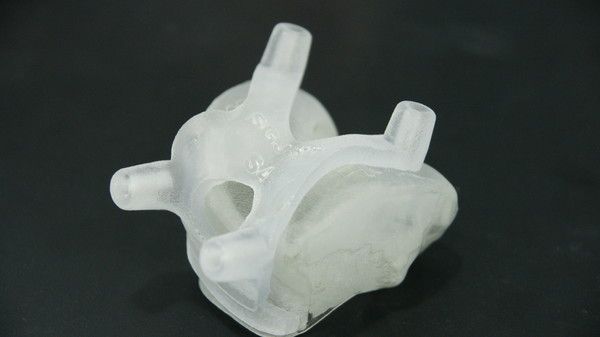 3D프린터로 재현한 환자의 무릎관절과 인공관절 수술도구(사진=연세사랑병원)