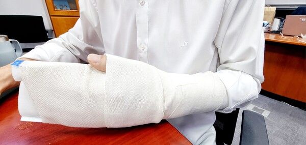 한창민 의원의 부상 실태 [사진=한창민 의원 페이스북]