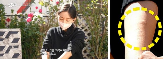 KBS&nbsp;‘시사직격’