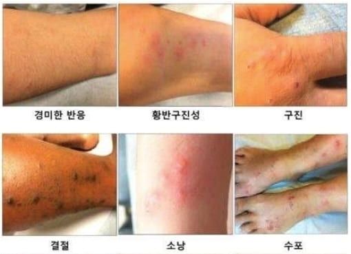 &nbsp;질병관리청