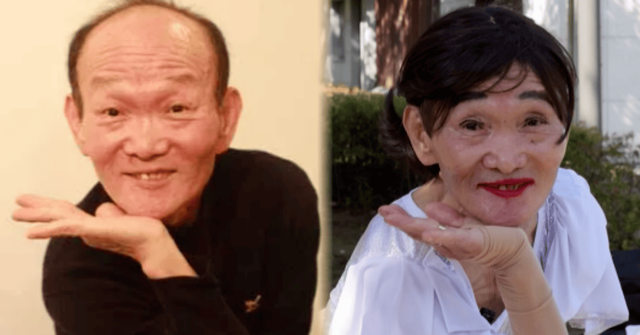 사진=온라인 커뮤니티 / 근황올림픽