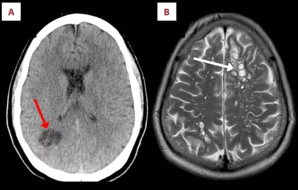 미 사례 보고서 저널