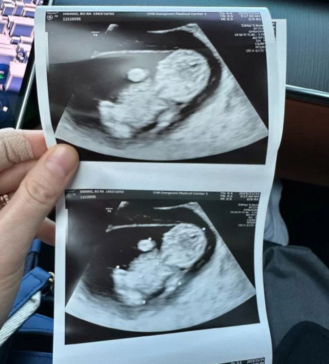 황보라 인스타그램