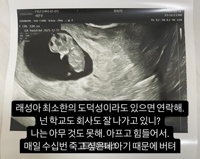 서민재 인스타그램