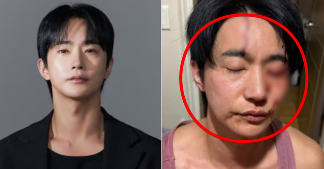 인터넷 커뮤니티 /&nbsp;전호준 인스타그램