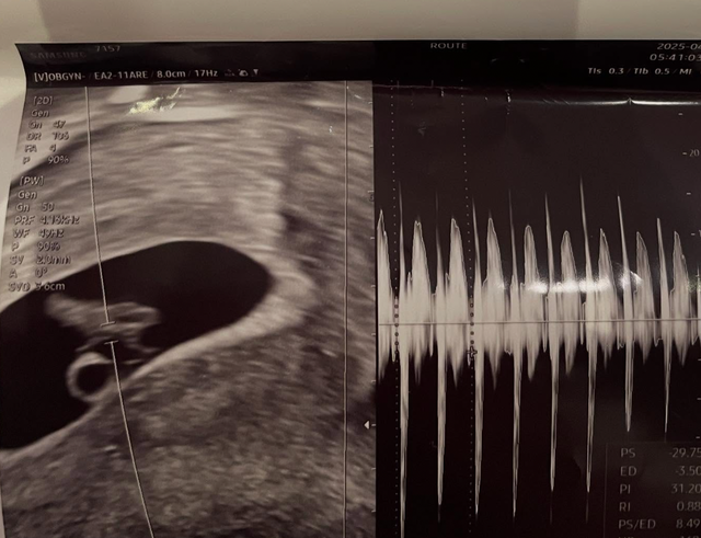 서민재 인스타그램