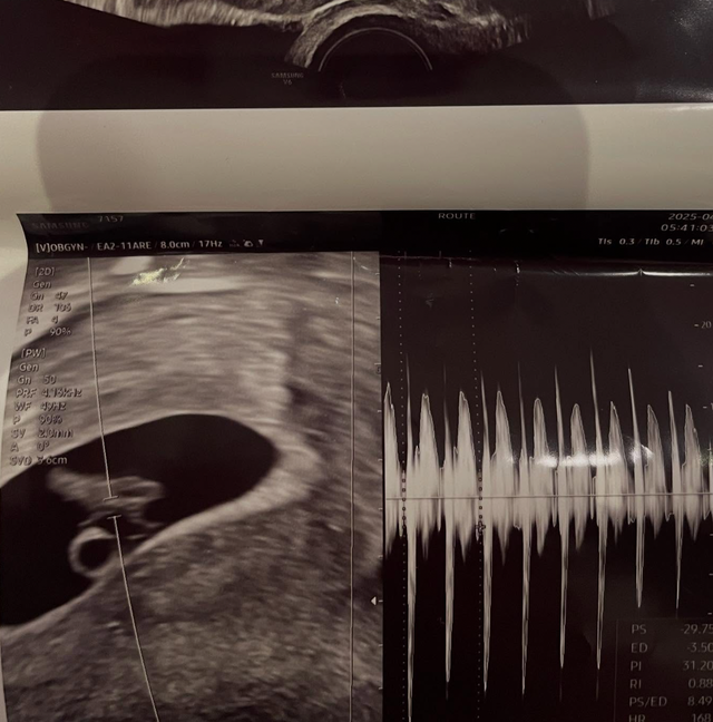 서민재 인스타그램