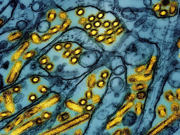 ▲ 컬러 전자 현미경으로 관찰한 조류 인플루엔자 A H5N1 바이러스의 모습(노란색). 사진=뉴시스