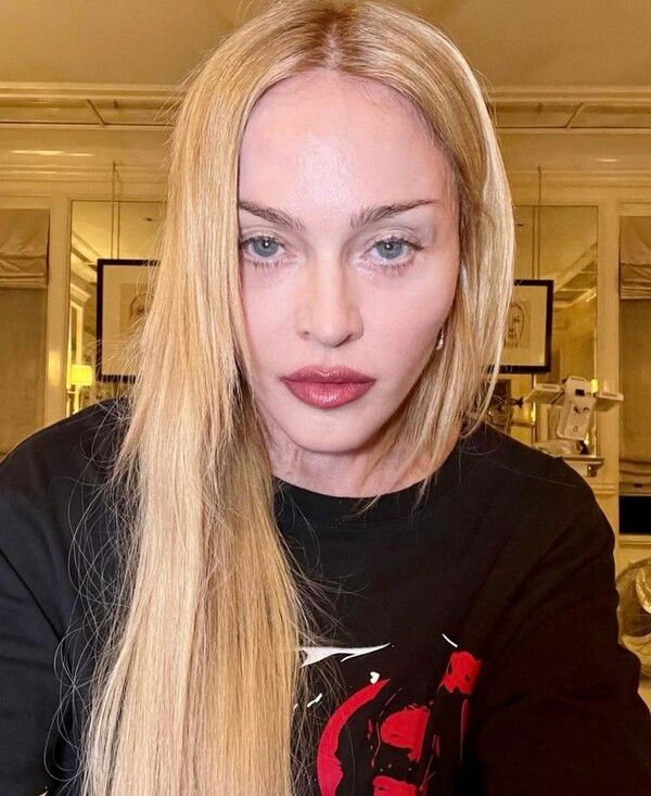 세계적 팝스타 마돈나. 사진┃마돈나 SNS