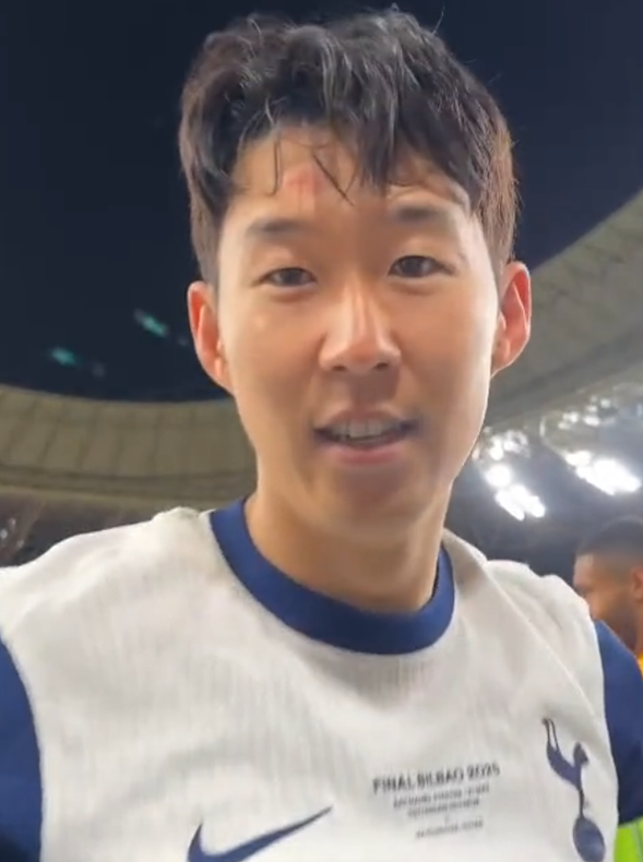 자신 이마에 난 상처를 보여주는 손흥민. 사진┃토트넘 홋스퍼 공식 SNS