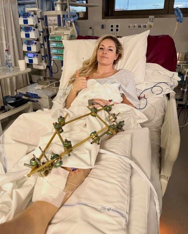 미국 알파인 스키 국가대표 린지 본. / 사진=린지 본 인스타그램