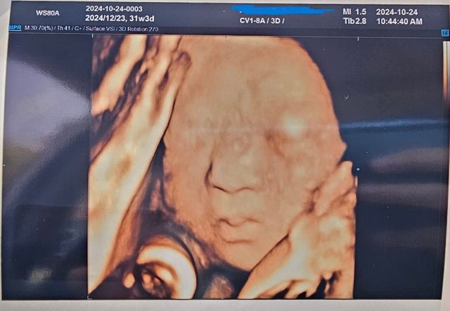 저 포좀 빨아도 되나요?