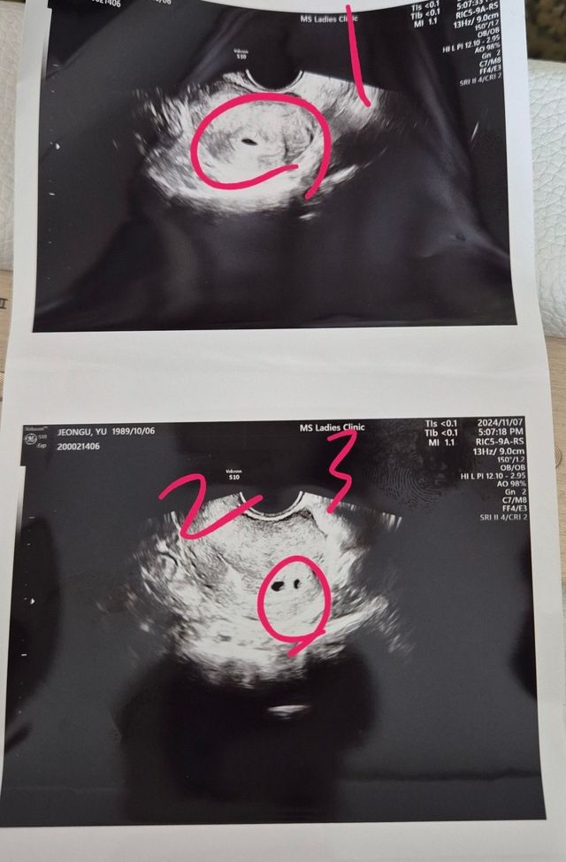 KakaoTalk_20241116_184152011.jpg 애국...큰거온다