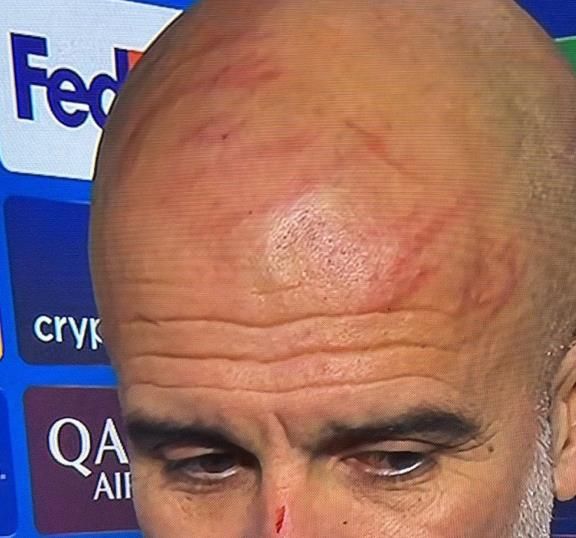 실시간 펩 얼굴 상태.......